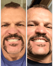 Load image into Gallery viewer, Snow Teeth Whitening™ At-Home System All-in-One Kit