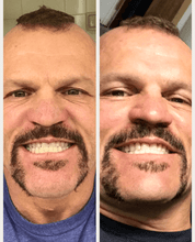 Load image into Gallery viewer, Snow® At-Home Teeth Whitening Kit