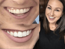 Load image into Gallery viewer, Snow® Teeth Whitening At-Home System [All-in-One Kit] - $99
