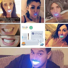 Load image into Gallery viewer, SNOW TEETH WHITENING™ SYSTÈME À DOMICILE [KIT TOUT-EN-UN]
