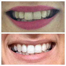Load image into Gallery viewer, Snow® At-Home Teeth Whitening Kit
