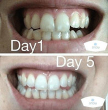 Load image into Gallery viewer, Special Offer - SNOW Teeth Whitening™ System
